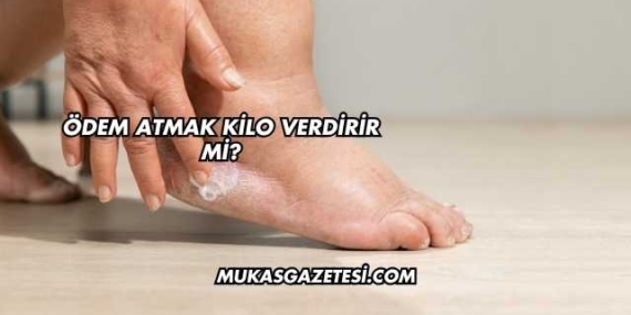 Ödem Atmak Kilo Verdirir mi?